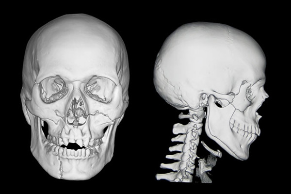 medical3d_3