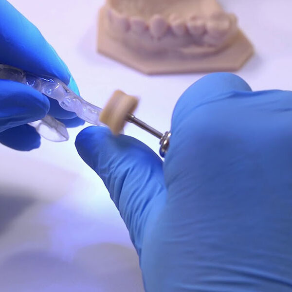 Formlabs Dental LT resin 3DHUB.gr