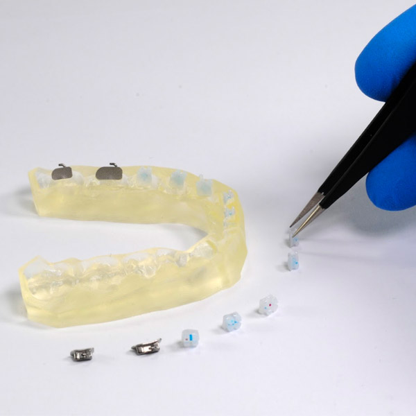 Formlabs Dental new IBT resin orthodontics 3DHUBgr