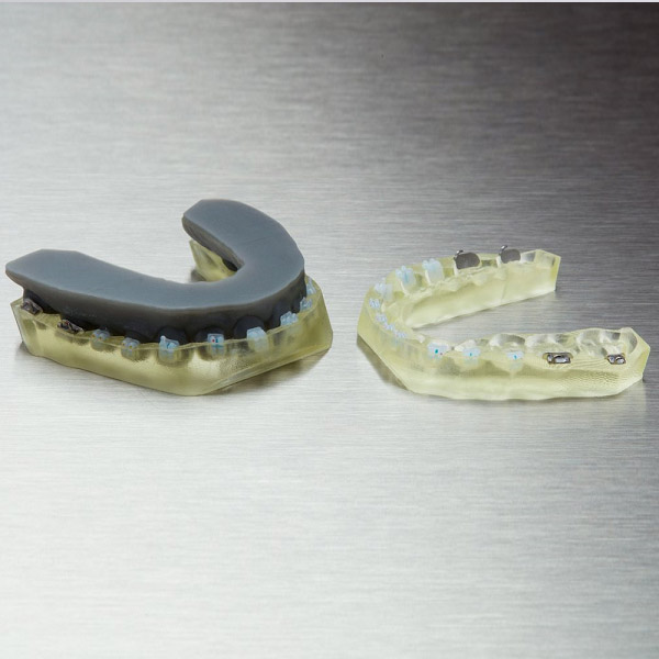 formlabs-ibt-dental-resin-3DHUBgr-03 Formlabs Dental new IBT resin orthodontics 3DHUBgr