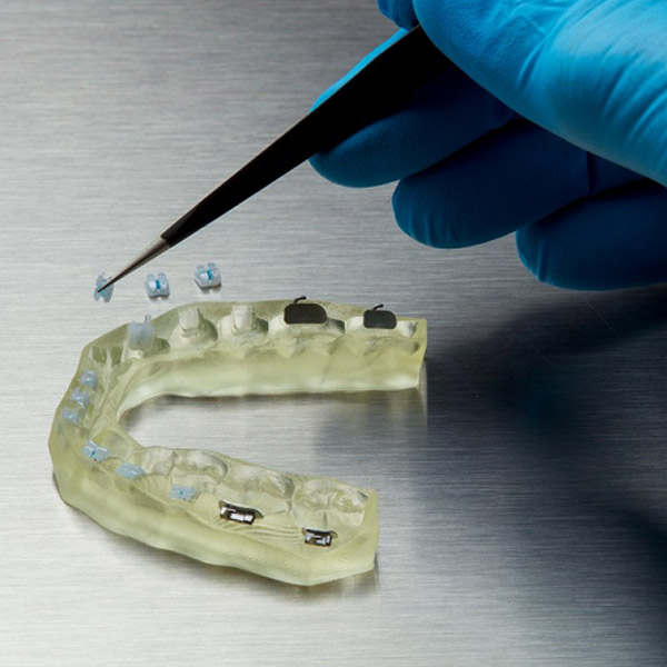 formlabs-ibt-dental-resin-3DHUBgr-05 Formlabs Dental new IBT resin orthodontics 3DHUBgr