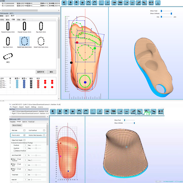 IsoleCAD orthotics software 3DHUBgr