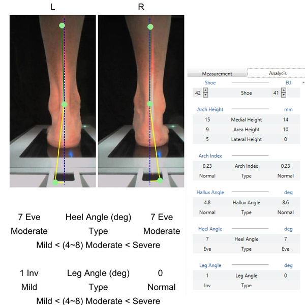 scanpod-usol-foot-3d-scanner-3DHUBgr