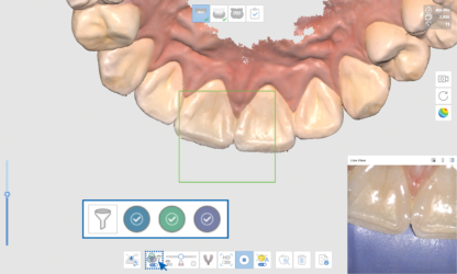 medit-i700-intraoral-3d-scanner-3DHUBgr-03 medit i700 intraoral 3d scanner 3DHUBgr