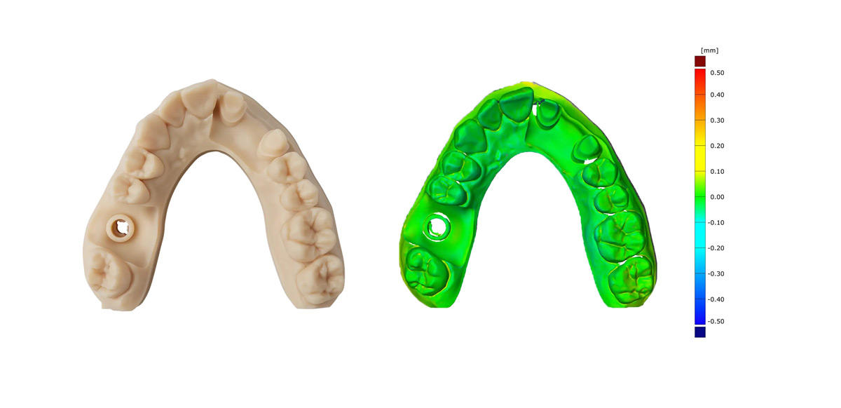 formlabs-form4B-dental-3dprinter-3DHUBgr